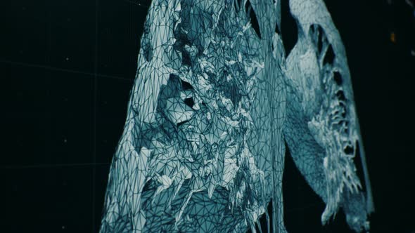 Modern medical tomography scanning lungs affected by pneumonia. Virus Covid-19 alt