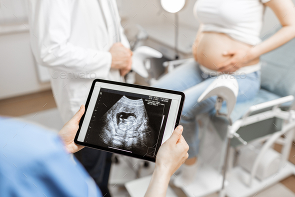 Medics with an ultrasound scan of unborn child during examination - Stock Photo - Images