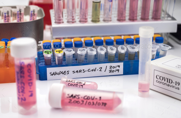 Vials with samples of SARS-COV-1 prepared cold in a laboratory - Stock Photo - Images