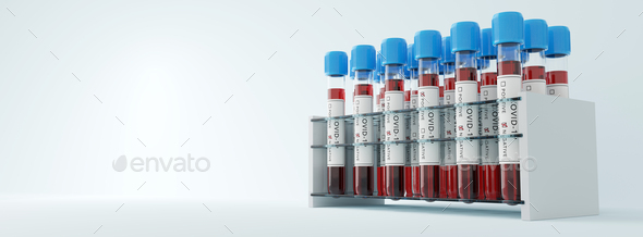 Coronavirus Covid19 test tubes in a rack. Medical screening and Covid tests production - Stock Photo - Images