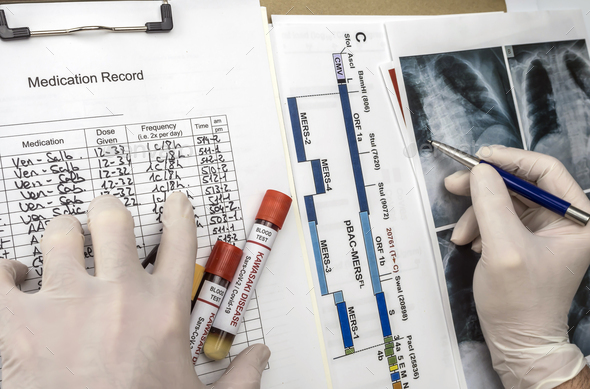 Doctor detects diagnosis in a child's lung affected by Kawasaki disease - Stock Photo - Images