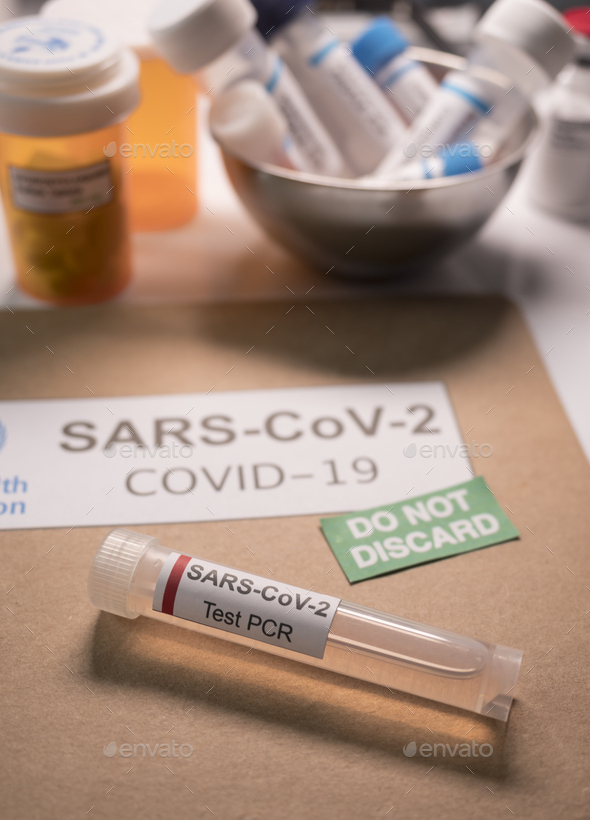SarsCov2 coronavirus pcr vial together with a dossier folder indicating not to be discarded