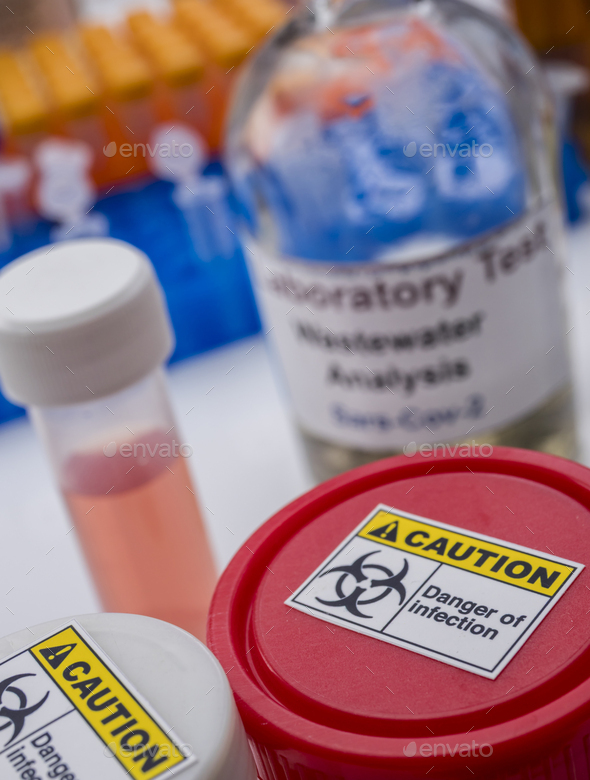 Scientific analysis of wastewater sample in laboratory Stock Photo by