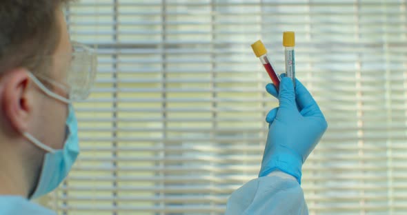 Doctor Looking Test Tube for Checking Covid-19 in the Blood Slow Motion. alt