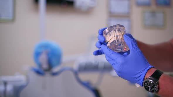 Artificial teeth in doctor's hands. Dentist shows on jaw model how to take out and put implant. alt