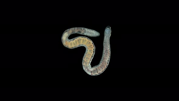Aulophorus sp worm under a microscope, family Naididae alt