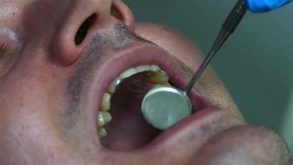 Dentist Checking Patient's Tooth