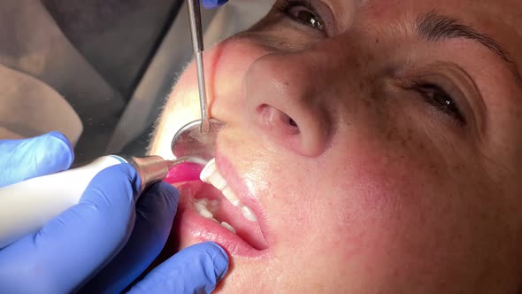 Woman Having Dental Treatment at Dentist's Office alt