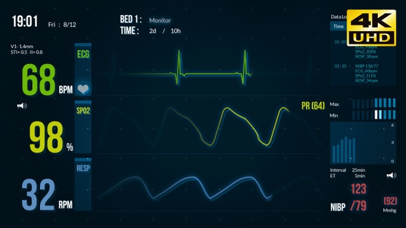 EKG ECG Screen Monitor Advance, Motion Graphics | VideoHive