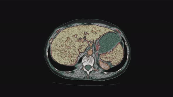Bulk Multicolored MRI of the Female Pelvic Organs Abdominal Cavity Gastrointestinal Tract and alt