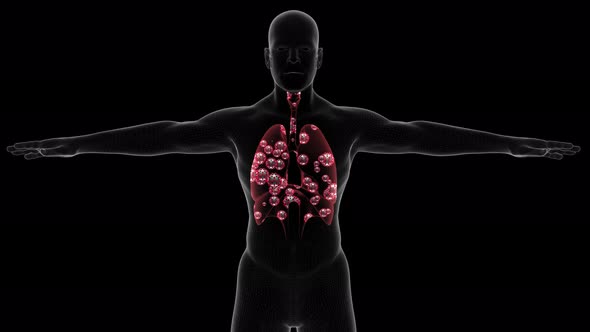 Lungs Infection Visualization With Alpha 4K