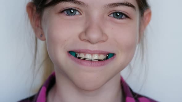 Little , Young Smiling Girl Wears an Orthodontic Dental Appliance , Retainer, Braces.