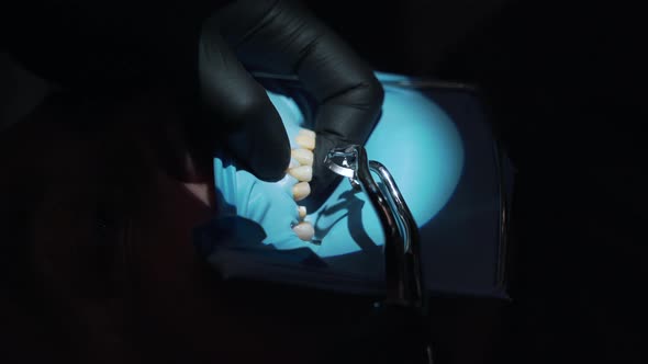 A Dentist Doing Surgery Close-up