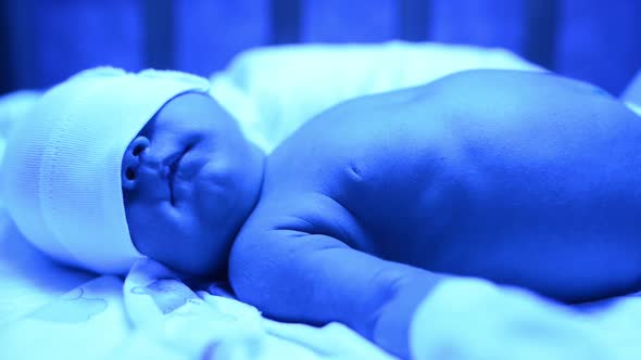 Newborn Having a Treatment for Jaundice Under Ultraviolet Lamp in Home Bed alt