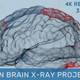 Human Brain X-Ray Projection - VideoHive Item for Sale