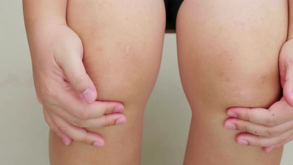 Man massages his knee from a sore cut with his hand. Trigger point health care concept alt