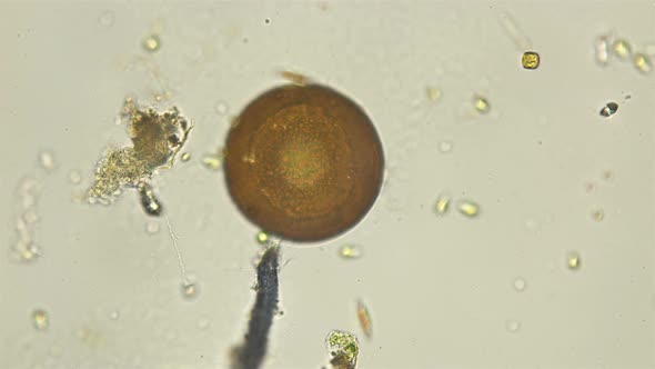Arcella's Amoeba Under a Microscope, Usually Found in Fresh Water and Mosses alt