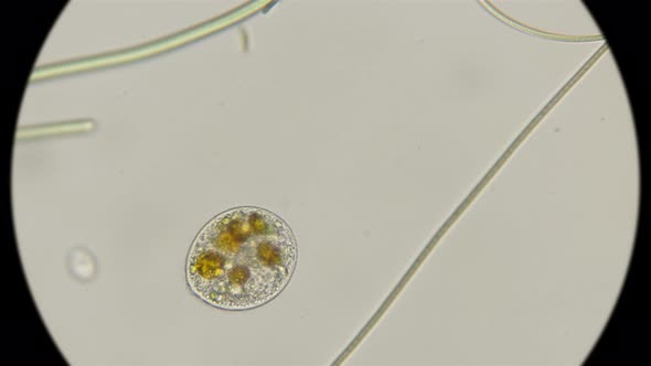 Infusoria Holophrya in Motion alt