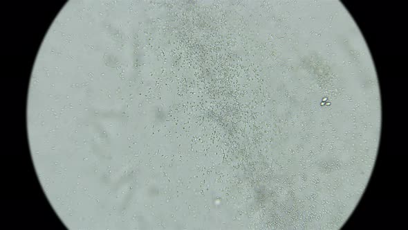 A Drop of Dirty Water with a Lot of Bacteria and Microorganisms alt