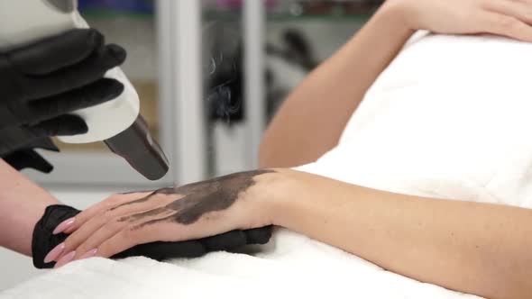 Close-up of Manipula Carbonic Peeling on Female Arm alt