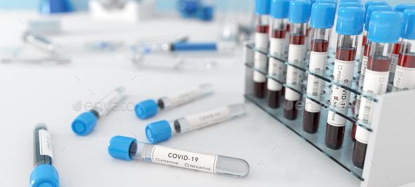 Testing for coronavirus Covid-19 in a lab. Covid medical screening