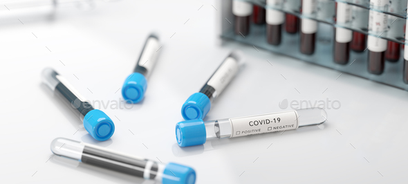 Testing for coronavirus Covid-19 in a lab. Covid medical screening - Stock Photo - Images