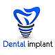 Dental Implant Logo, Logo Templates | GraphicRiver