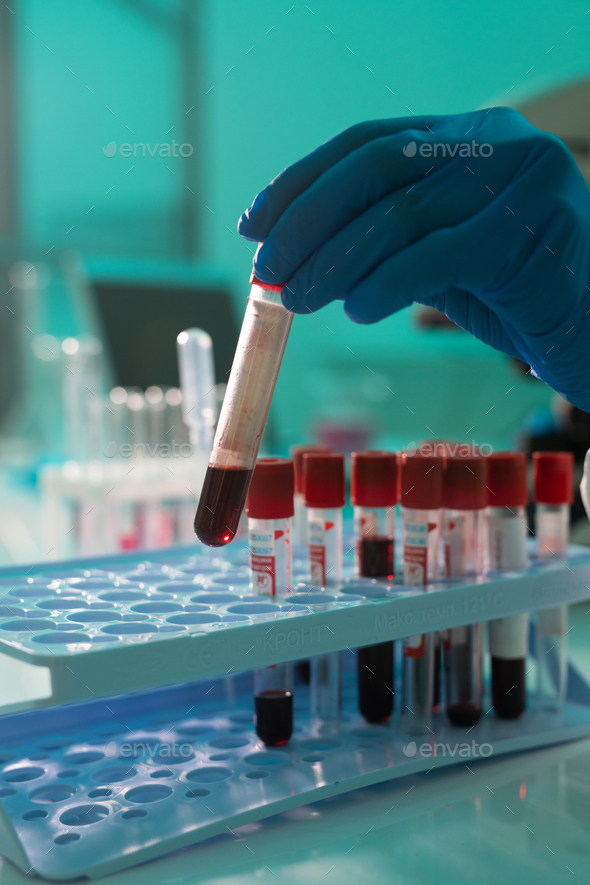 Gloved hand of researcher or laboratory worker working with samples of blood