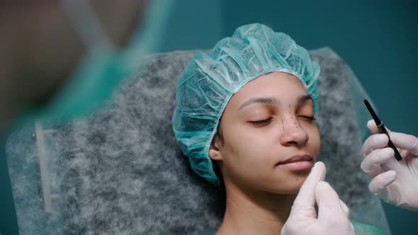 Surgeon Draws Lines on a Girl's Face Before Rhinoplasty Wearing Gloves