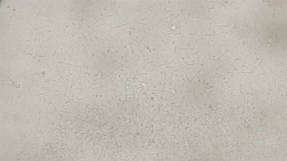 Colony of Rod-shaped Bacteria Appearing in Decaying Organisms alt