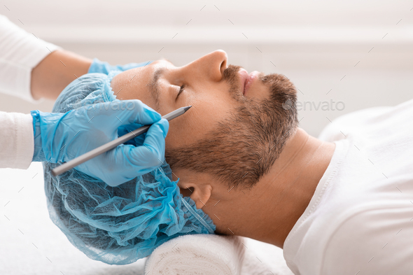 Handsome man getting pencil marks under eyes before surgery