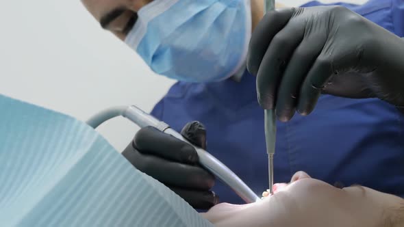 Closeup A Male Pediatric Dentist Grinds a New Filling in the Tooth of a Little Girl with Her Mouth alt