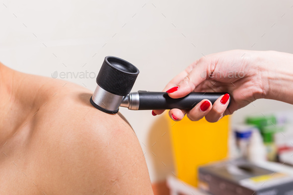 Method of dermoscopy of skin lesions and moles. Preventing Melanoma and Skin Cancer
