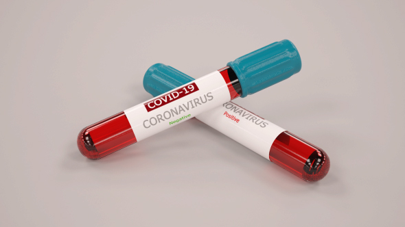 Corona Blood Test - 3Docean 29901080