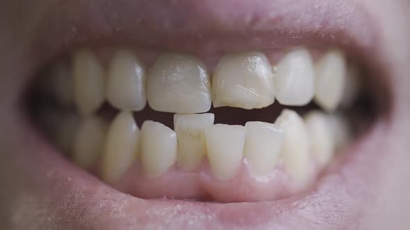 A Man Shows His Crooked Teeth alt