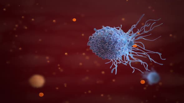 Clogged Artery with platelets and cholesterol plaque, concept for health risk for obesity alt