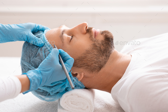 Handsome man getting pencil marks on forehead before surgery