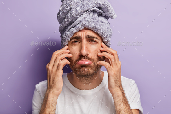 Close up shot of dissatisfied man touches face, has bad feelings after spa procedures, wears towel o