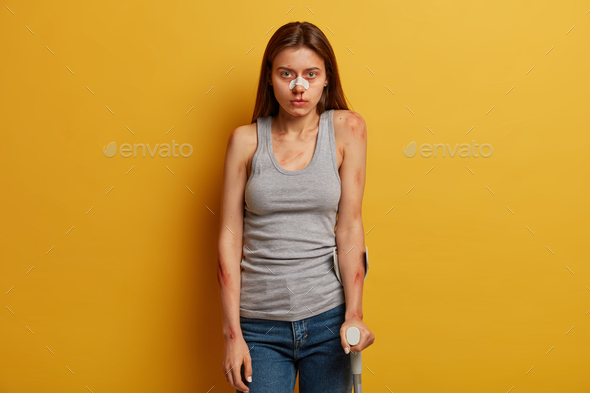 Health problems and insurance concept. Portrait of unhappy woman with broken nose, scartches and wou