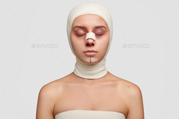 Photo of young female has contour plastic, gets ready for cosmetic surgery, has doted lines on eyeli