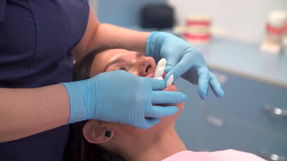 Dentist at Work Performes Whitening Procedure