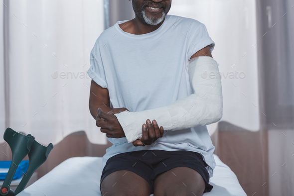 Cropped image of african american patient with broken arm in plaster cast