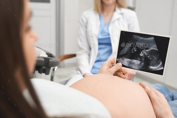 Ultrasound screen of future child in hands of mother