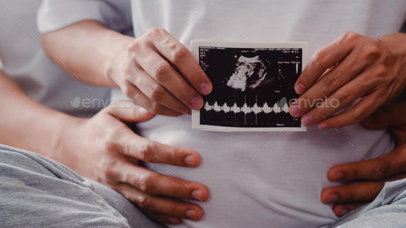 Young Asian Pregnant couple show and looking ultrasound photo baby in belly. - Stock Photo - Images