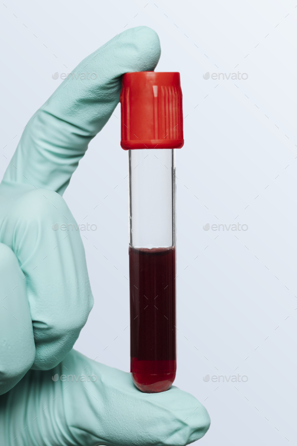 Download Hand Holding A Blood Test Tube Mockup Stock Photo By Rawpixel Photodune