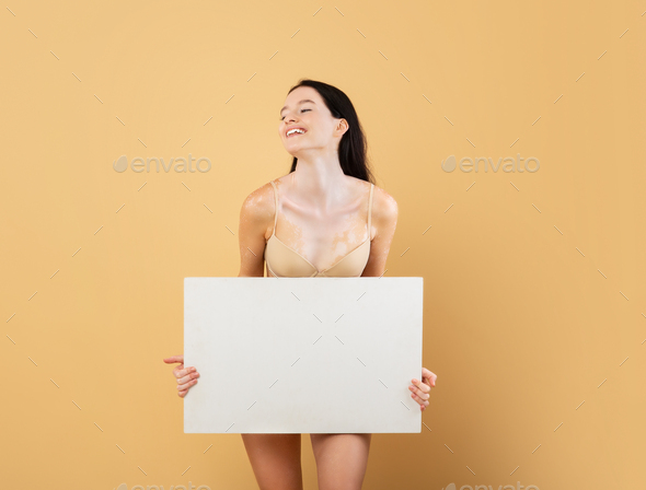 Smiling young female with vitiligo skin disorder holding white blank placard