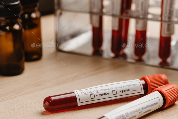 COVID-19 blood test in test-tube, sample of blood testing for diagnosis new Corona virus infection