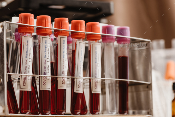 COVID-19 blood test in test-tube, sample of blood testing for diagnosis new Corona virus infection