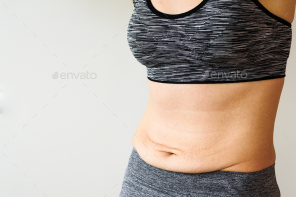 Woman belly after dieting