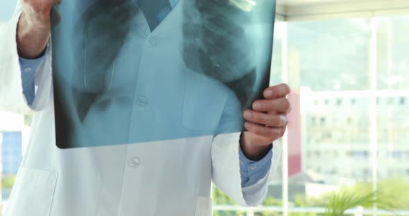 Serious doctor looking at Xray alt